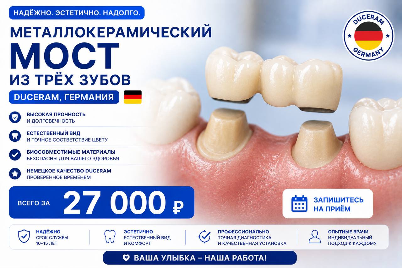 Мост металлокерамический на 2-х имплантатах