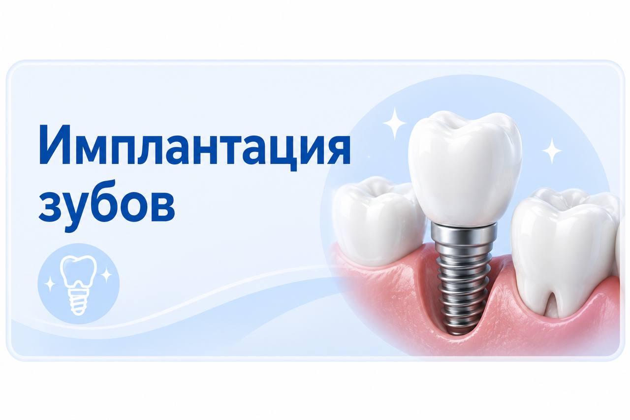 Имплантация